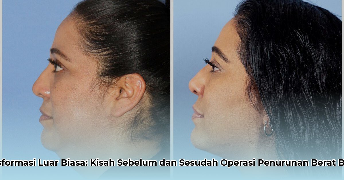 weight loss surgery before and after pictures
